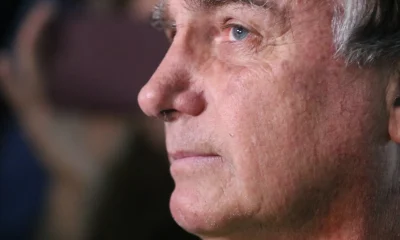 Bolsonaro tem picos de pressão alta e mantém tratamento para soluços, relatórios médicos são enviados ao STF