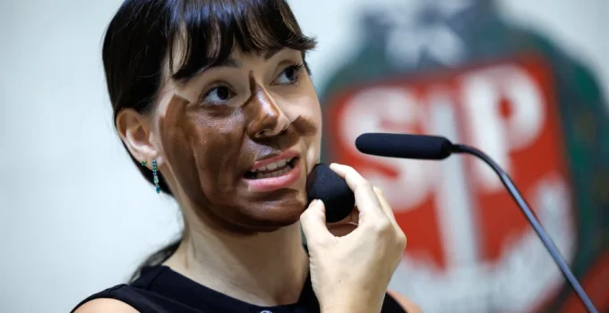 MP de SP pede arquivamento de caso de "blackface" contra Fabiana Bolsonaro; imunidade parlamentar em foco